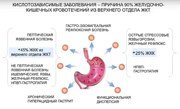 Что такое гастропатия