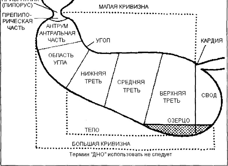 Кто такой привратник. Каскадная деформация желудка. Каскадный желудок схема. Каскадный желудок 1 степени. Каскадное строение желудка.