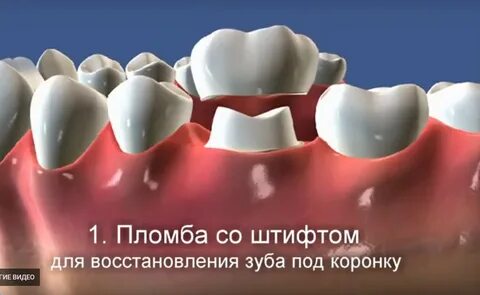 Пломбированный штифт