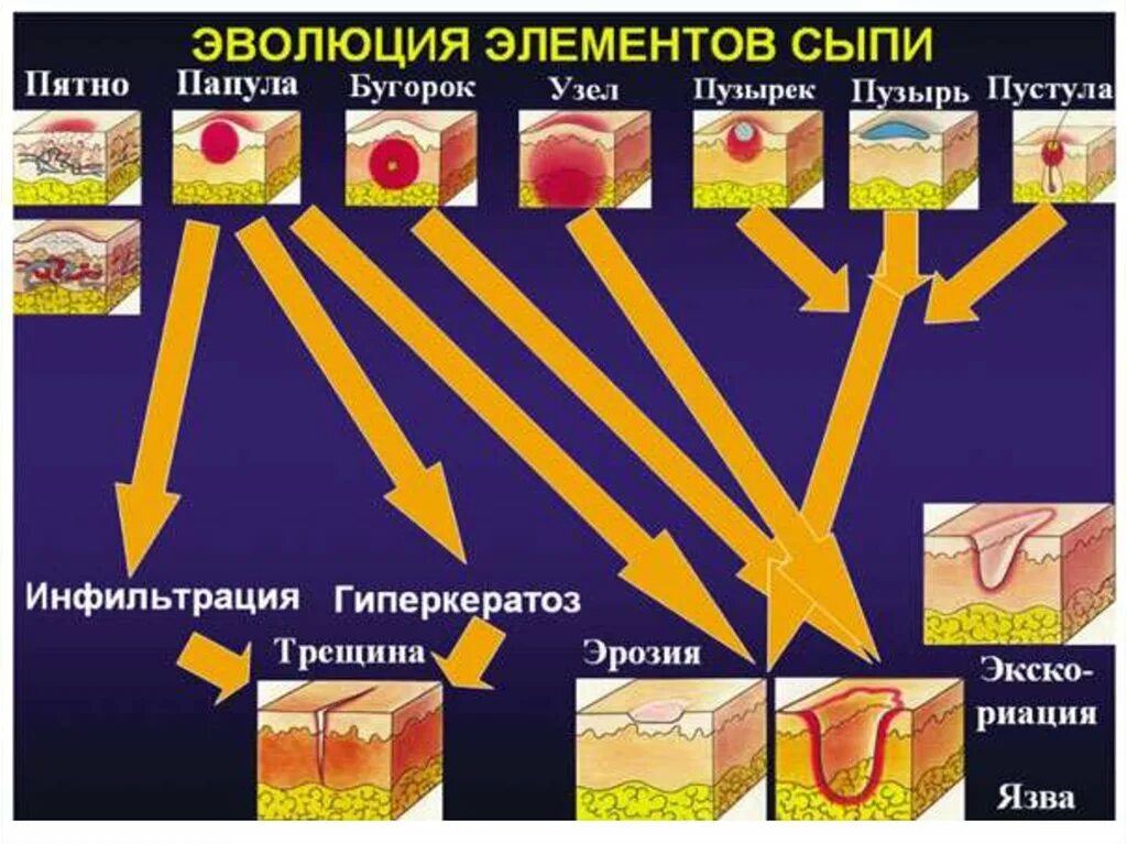 Первичные и вторичные поражения