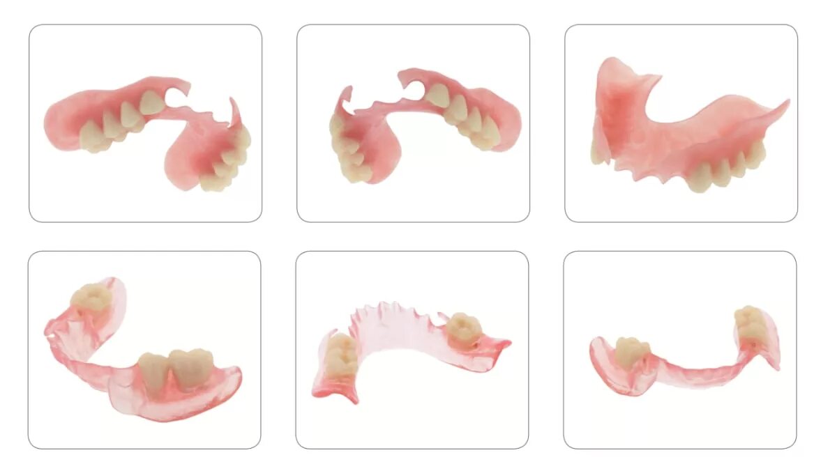 Вертекс частично съемный протез. Съемный пластинчатый протез (1 пластина). Нейлоновые протезы Вертекс.