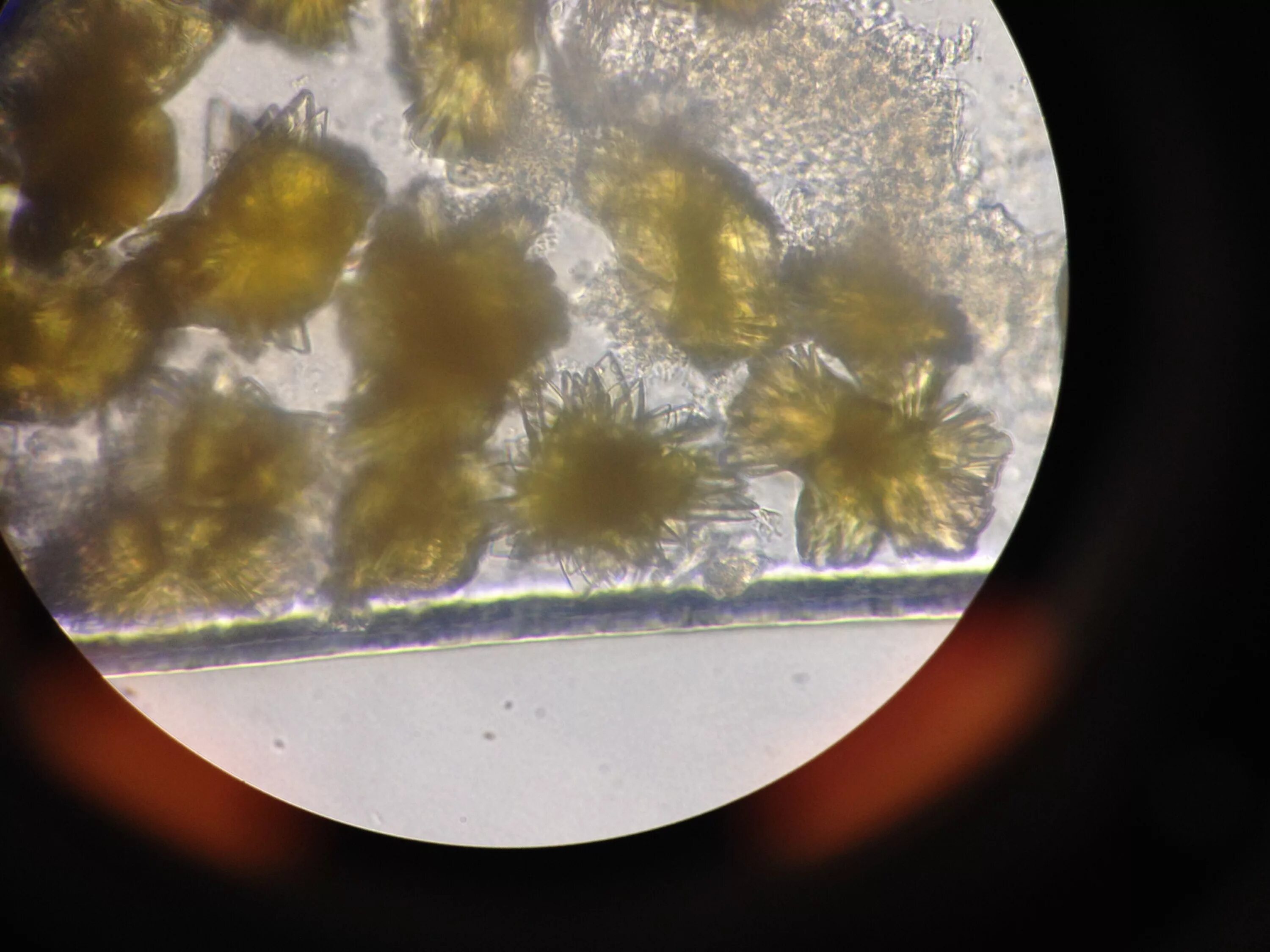 Иглы в моче. Кристаллы мочевой кислоты микроскопия. Микроскопия желчи под микроскопом. Струвиты микроскопия. Кристаллы мочевой кислоты под микроскопом.