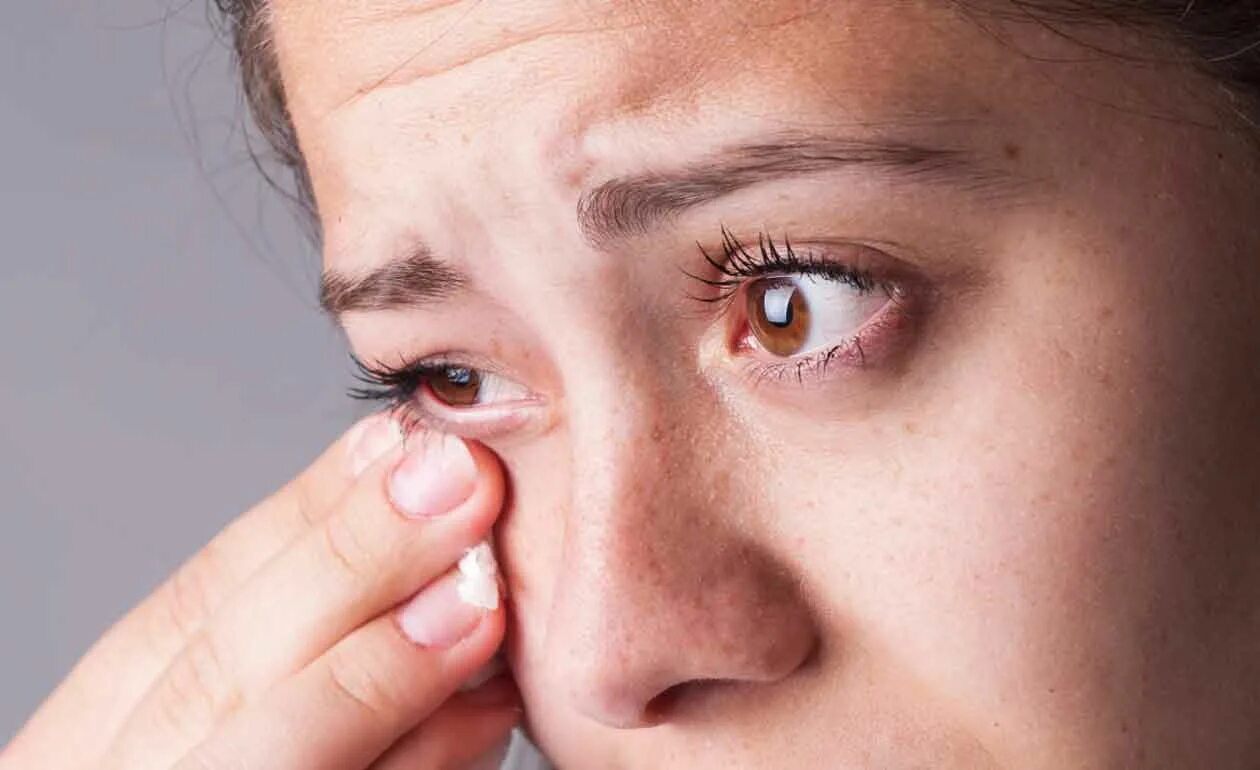 Лечение слезотечения глаз у взрослых