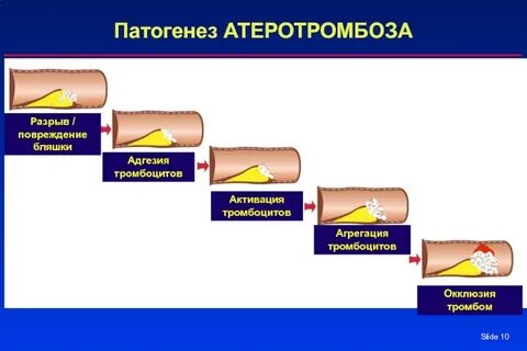 Условие бляшке
