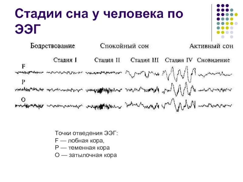 Ээг сигнал. Фазы сна показатели ЭЭГ. Фазы сна на ЭЭГ. 1. Нарисовать схему стадий сна по данным ЭЭГ.. ЭЭГ-корреляты фаз сна..