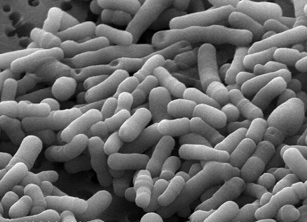 Палочка бифидобактерии. Бифидобактерии вв12. Бифидобактерии лонгум. Лаксто бактери бифида бакт. Бифидо и лактобактерии под микроскопом.
