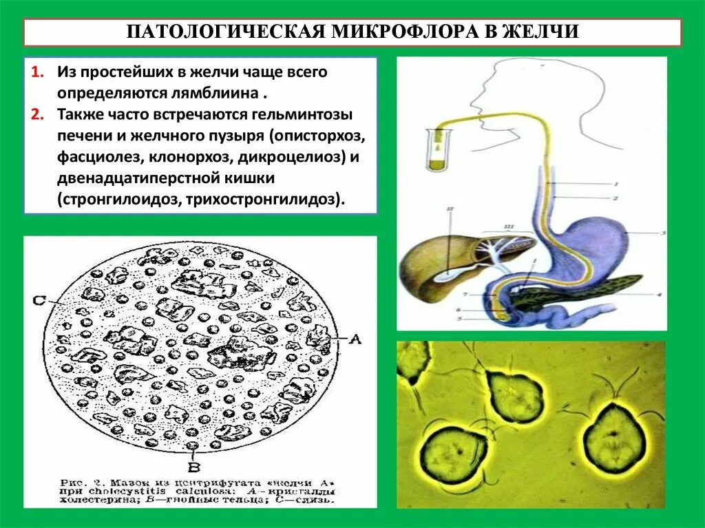 Кал на желчные кислоты. Микроскопическое исследование желчи. Микроскопия желчи. Простейшие в желчи. Желчь микроскопия с описанием.