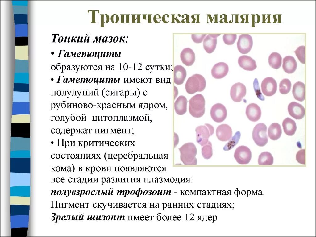 Мазок крови больного малярией гаметоцит. Тропическая малярия мазок крови. Малярия микроскопия тонкий мазок. Мазок крови больного трёхдневной малярией.