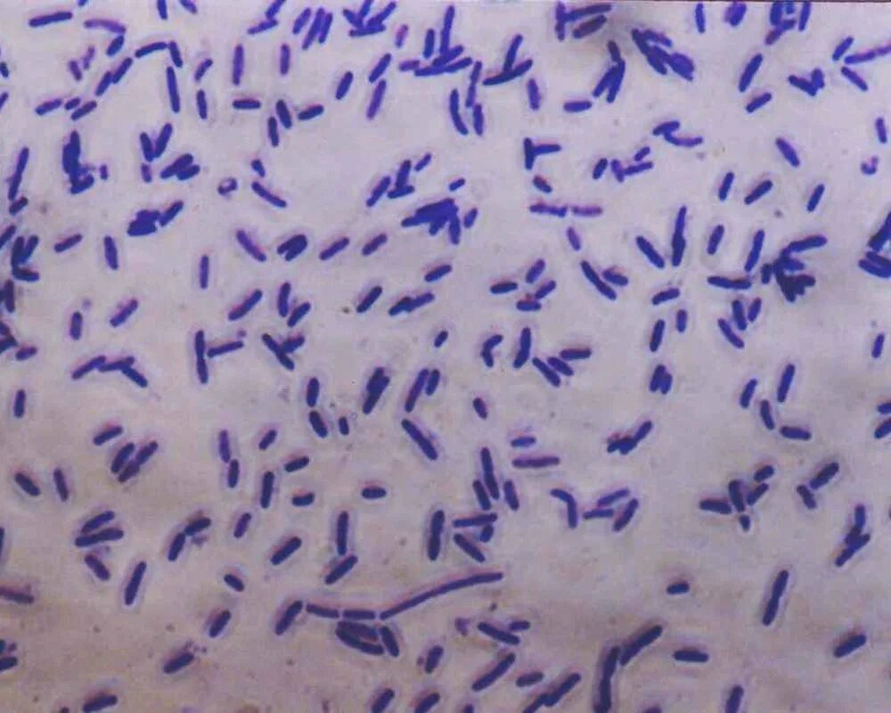 Синегнойная палочка микроскопия. Пастереллез микроскопия. Синегнойная палочка по Граму. Pseudomonas aeruginosa по Граму. Бактерия синегнойная палочка