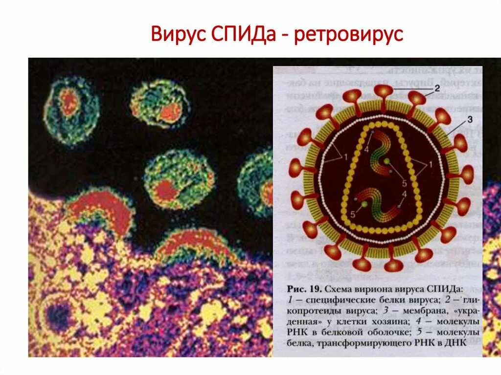 Вирусы семейства Retroviridae. Ретровирус СПИДА. Ретровирусы ВИЧ. Ретровирус микробиология.