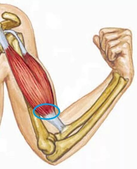 К чему крепится бицепс. Анатомия сухожилия двуглавой мышцы. Сухожилие бицепса плеча анатомия. Сухожилие двуглавой мышцы плеча анатомия. Тенотомия сухожилия бицепса.