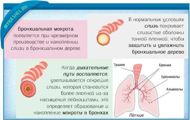 Сколько кашель после бронхита. Кашель с мокротой из бронхов. Кашель с мокротой у взрослого.