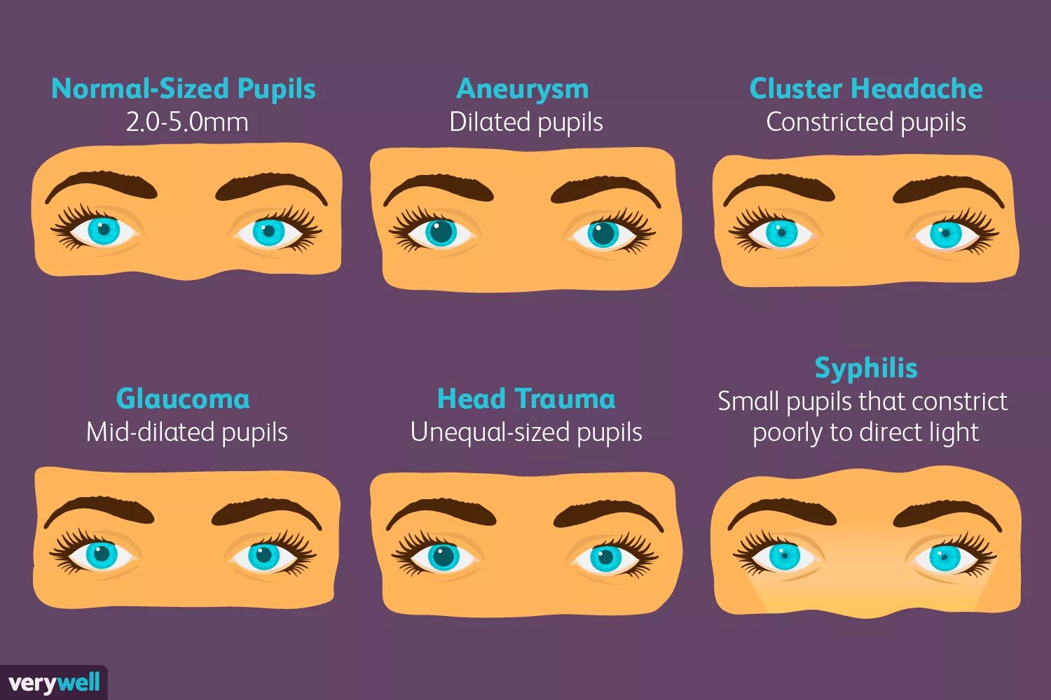 These are my pupils. Normal sized pupils. Pupil Sizes.