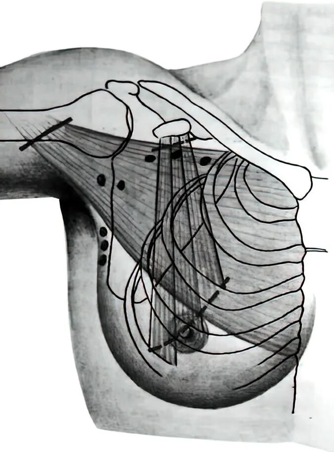 мастэктомия по холстеду майеру. резекции лимфоузлов молочных желез. радикальная мастэктомия по маддену протокол операции. регионарные лимфоузлы грудной железы. молочная железа лимфоотток топографическая анатомия.