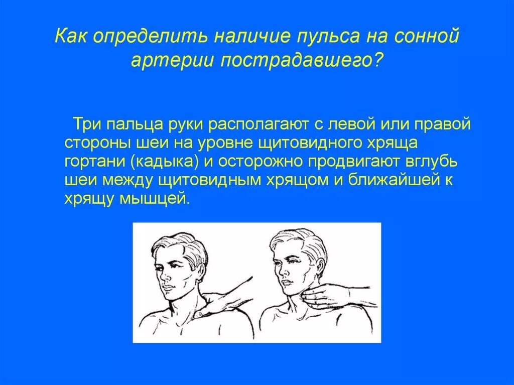 Как определить наличие пульса на сонной артерии пострадавшего?. Как определить наличие пусльа на сонной артеии почтрадавшего. Как определить пульс на сонной артерии пострадавшего. Как определить пульс на сонной артерии. Сонная артерия где находится как нащупать