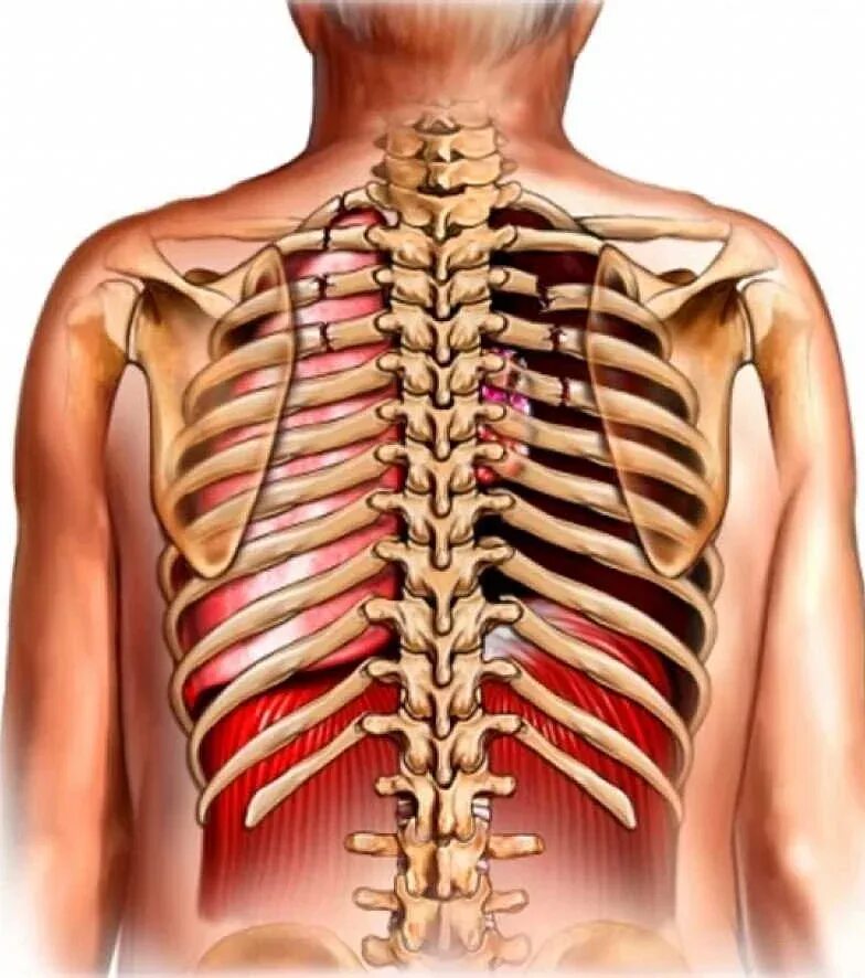 Перелом ребер грудной клетки. Перелом 9 ребра грудной клетки.
