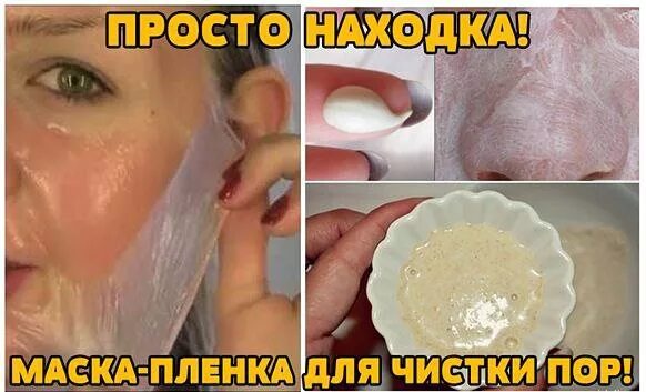 Маска от черных точек без желатина. Маска для распаривания кожи. Маска от прыщей. Маска от избавления прыщей. Маски для лица в домашних от прыщей.