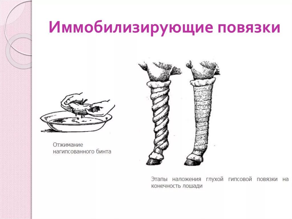 Наложение повязки при открытом переломе. Наложение иммобилизирующей повязки. Иммобилизирующая шинная повязка. Перевязки при переломах верхних конечностей. Наложение иммобилизирующей повязки.