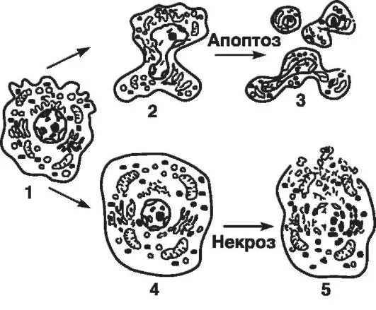 Апоптоз и некроз схема. Изменение клетки при некрозе и апоптозе схема. Некроз клетки схема.