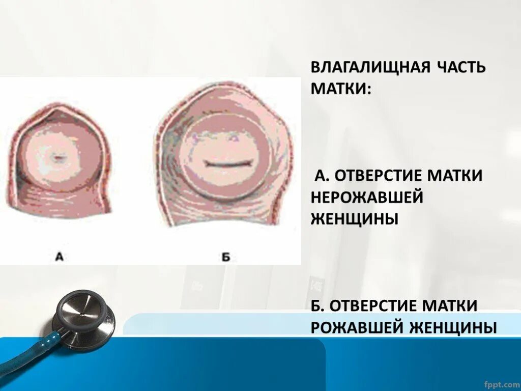 Влагалище Нерожавшей Женщины