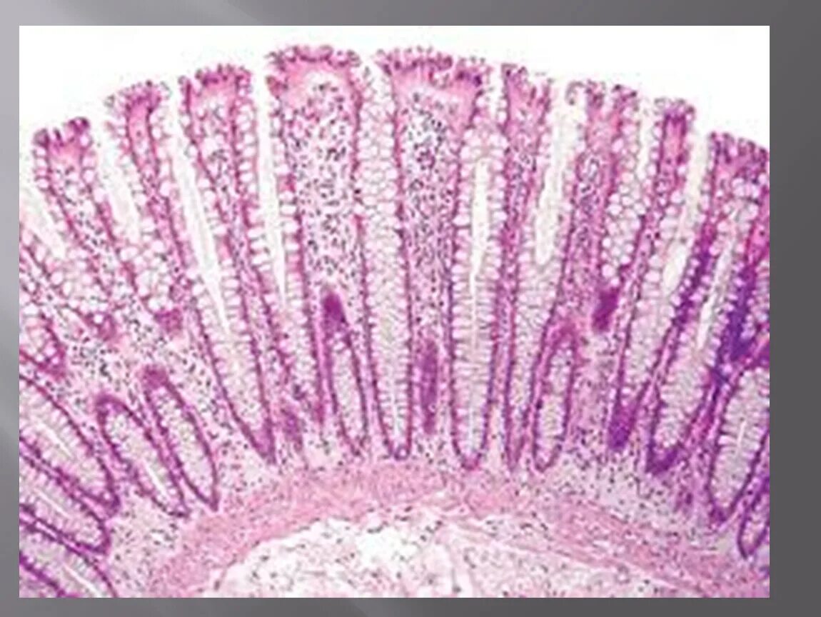 Толстая кишка гистология препарат. Эпителий кишечника гистология препарат. Толстая кишка микропрепарат гистология. Каемчатый эпителий гистология. Ткани тонкой кишки