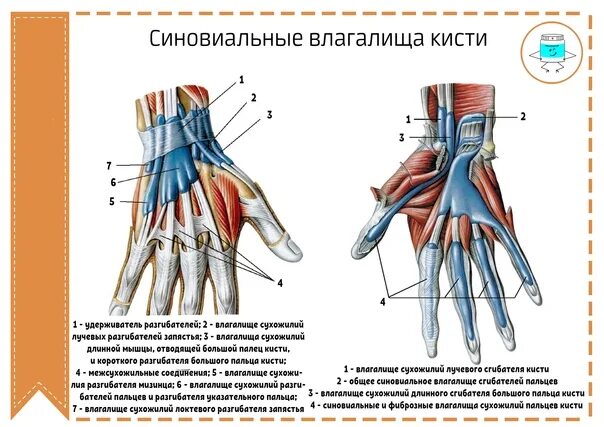 Тендовагинит сухожилий сгибателей пальцев. Синовиальные влагалища сухожилий кисти. синовиальные влагалища сгибателей кисти. синовиальные влагалища сухожилий сгибателей. синовиальные влагалища мышцы запястья и кисти.