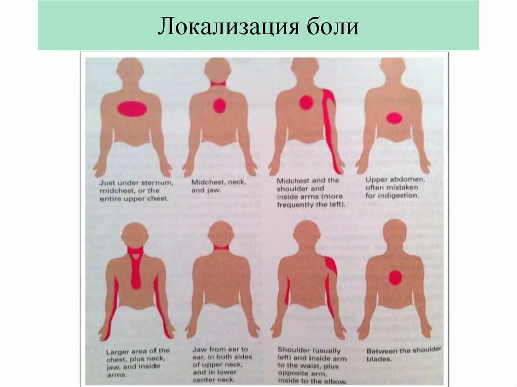 Заболевания локализация боли. Локализация боли в сердце. Локализация боли в груди. Локализация боли при различных заболеваниях.