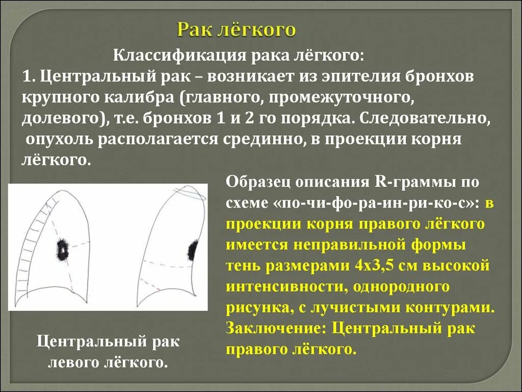 Центральная опухоль легкого. Центральное CR левого легкого. Онкология правого легкого. Центральное заболевание легкого.