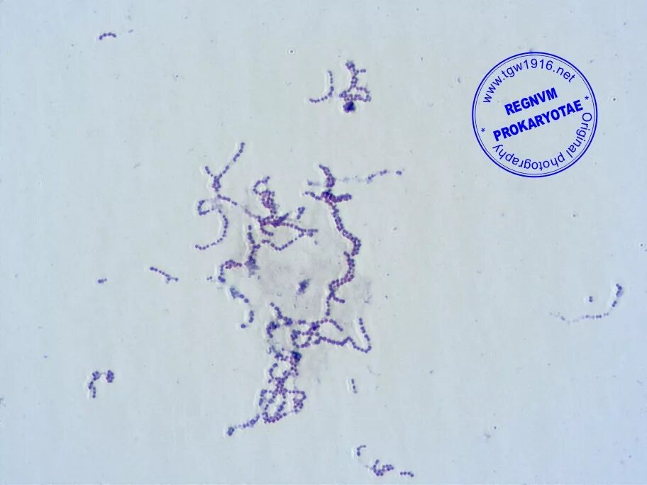 Стрептококки представители. Streptococcus agalactiae микробиология. Бактерии Streptococcus Equi. Streptococcus dysgalactiae.