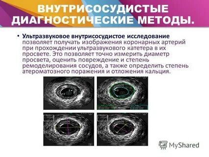 4 ультразвуковые методы