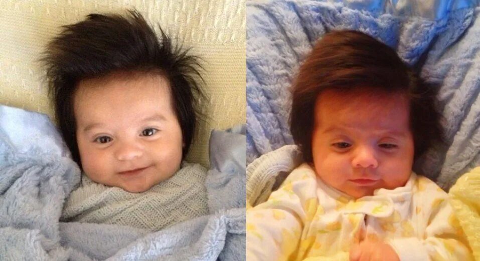 Дети рождаются с волосами. Ребёнок родился с волосами. Младенец с волосами. Ребенок родился с шевелюрой. Могут ли дети родиться с волосами