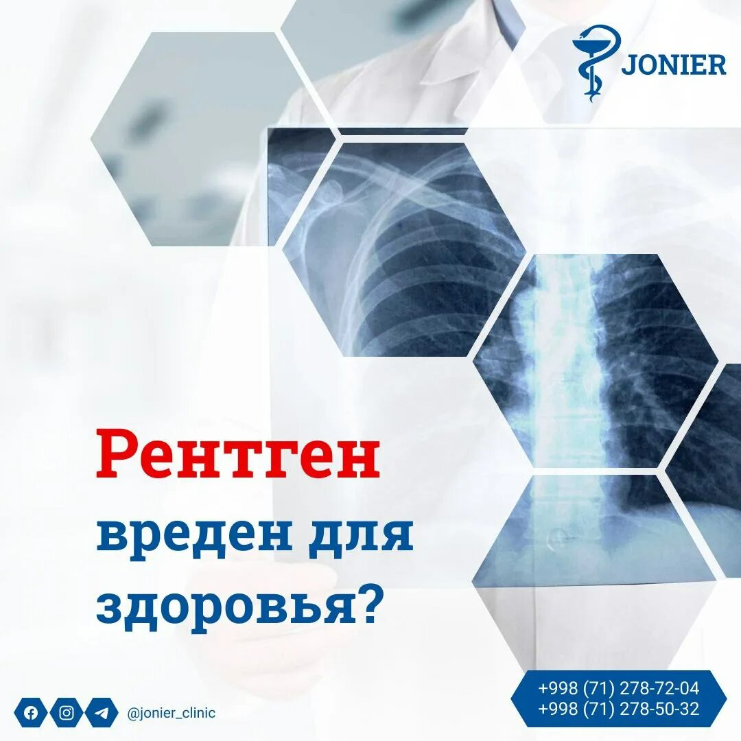 Рентгеновское излучение влияние на человека. Рентген вреден для здоровья. Рентген вреден для здоровья. Рентгенолог. Рентген вреден для здоровья.