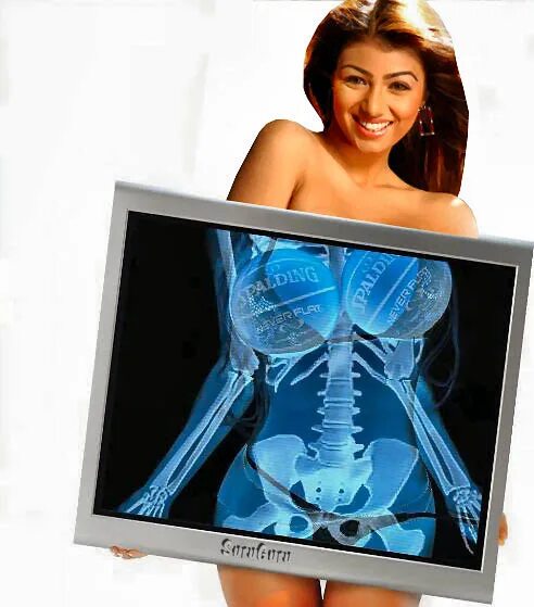 Scan v 3.0. X-ray scan v3. x-ray scan v 3.0. a-ray scanner что это. x-ray scanner java.
