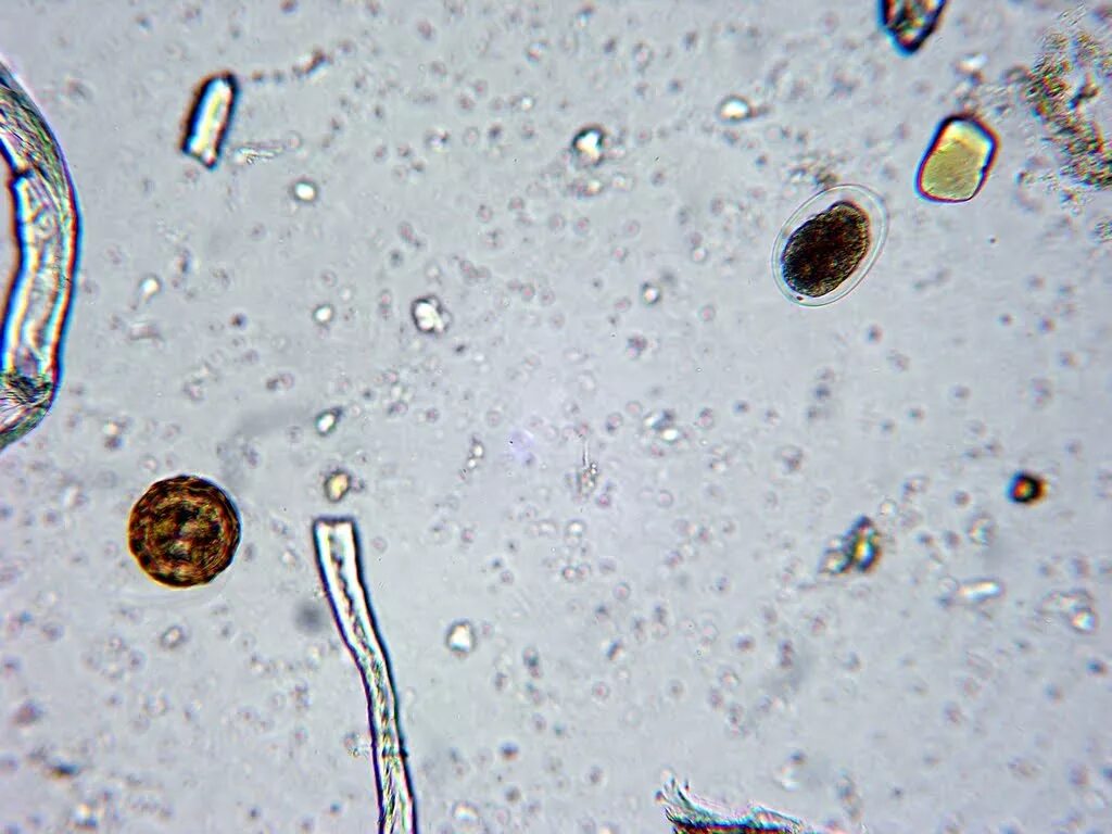 Цисты лямблии микроскопия. Яйца глистов микроскопия. Цисты лямблий микроскопия. Циста лямблии под микроскопом. Споры в кале у взрослого