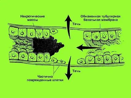 Какие клетки на базальной мембране