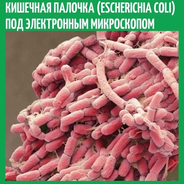 Escherichia coli симптомы отравления. Escherichia coli непатогенные. Бактерии группы кишечной палочки. Вирус кишечной палочки. Кишечные палочки какая группа