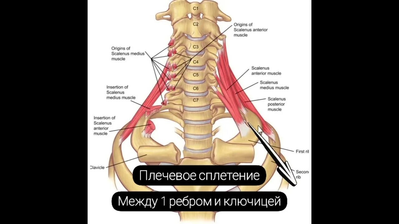 Лестничные мышцы шеи анатомия. Лестничная мышца анатомия. Scalenus anterior мышца. Расслабление лестничных мышц.