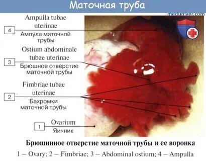 Связки маточной трубы
