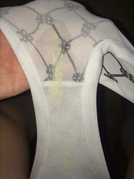 Подтекание вод. Подтекание околоплодных вод. Подтекание вод как выглядит форум. Подтекание околоплодных. Положительный тест на подтекание околоплодных вод.