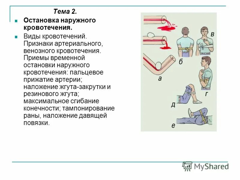 Мероприятия относящиеся к временной остановке наружного кровотечения. Временная остановка наружного кровотечения. Мероприятия по остановке наружного кровотечения. Способы остановки наружного кровотечения. Перечислите способы временной остановки кровотечения.