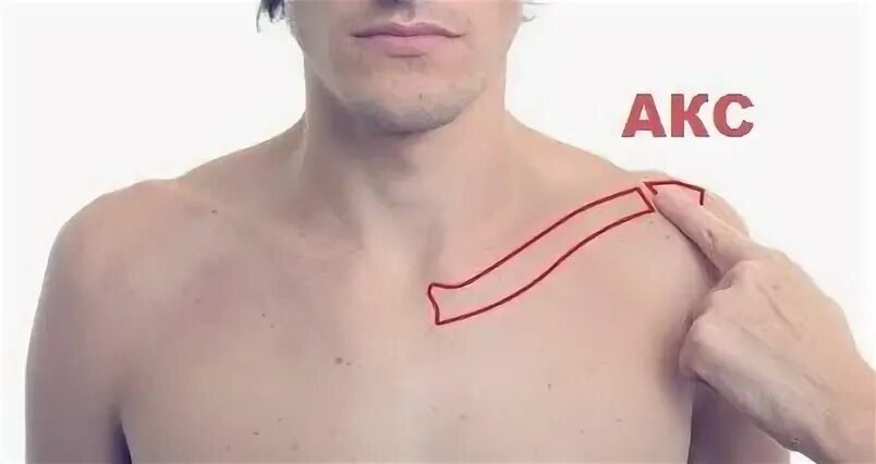 Надключичные и подключичные лимфоузлы. Боли спереди под ключицей. Шрам после операции на ключице. Перелом ключицы рентген. Боли спереди под ключицей.