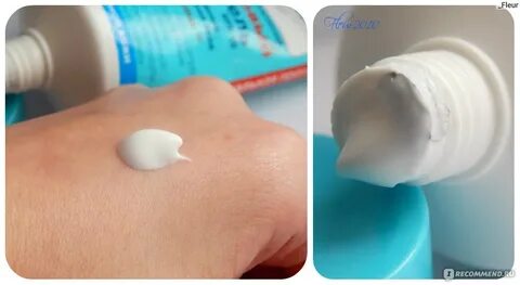 Салициловая кислота от закрытых комедонов