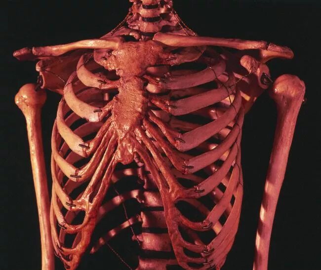 Ребра человека. Скелет грудной клетки. Грудная клетка ребра. Скелет человека ребра.
