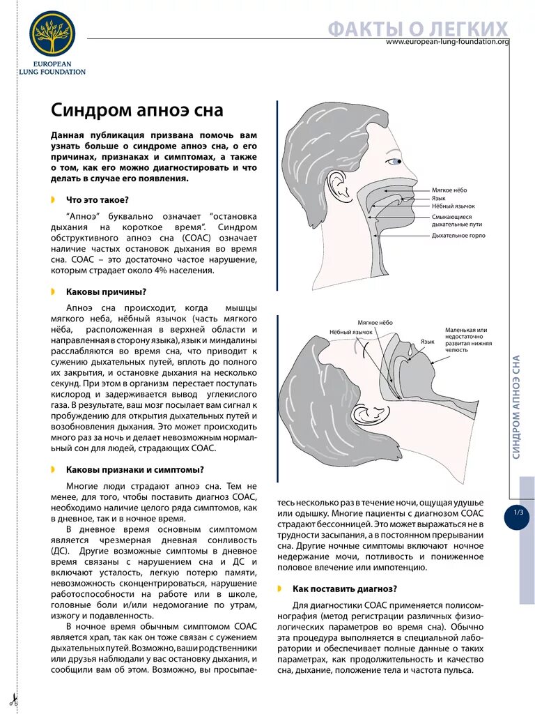 Правильное положение головы при сне. Правильное положение тела во сне. Положение головы при храпе. Спать с открытым ртом причины