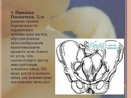Сынок матка