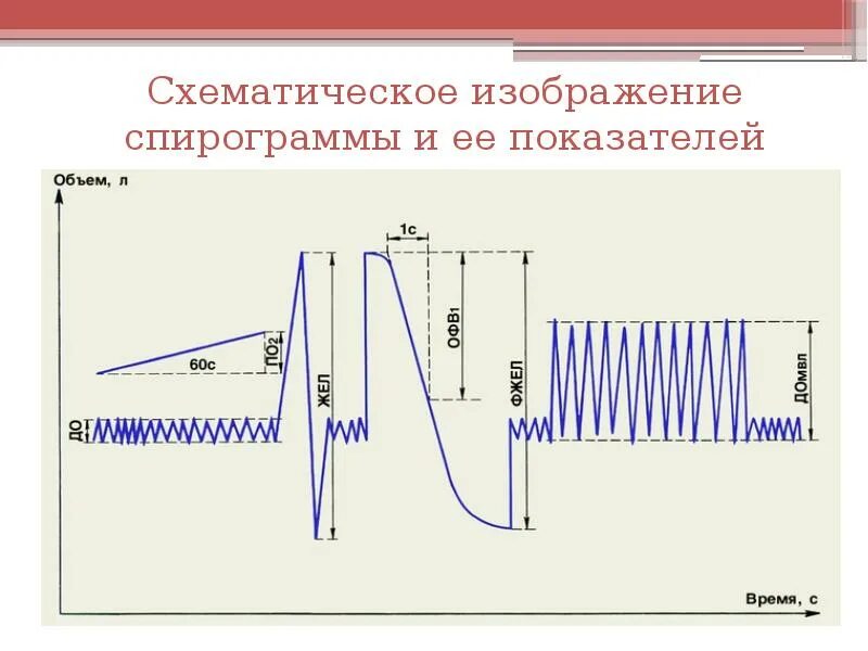 Спирограмма мужчины показала что резервный объем. Дыхательный объем на спирограмме. спирограмма легких физиология. спирограмма схема физиология. спирограмма легких что это.