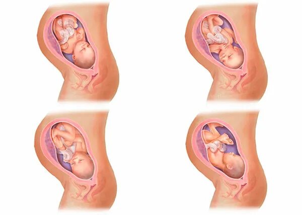Как лежит малыш в животе. Расположение ребенка на 7 месяце. Расположение малыша в животике. Плод на 8 месяце беременности.