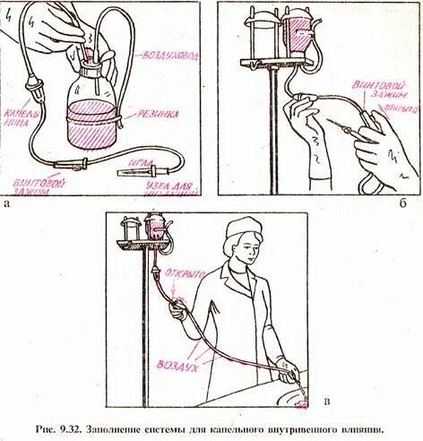 Алгоритм сбора системы для внутривенного капельного вливания. Устройство системы для внутривенного капельного вливания схема. Заполнение системы для внутривенного капельного вливания алгоритм. Внутривенное капельное Введение жидкости.