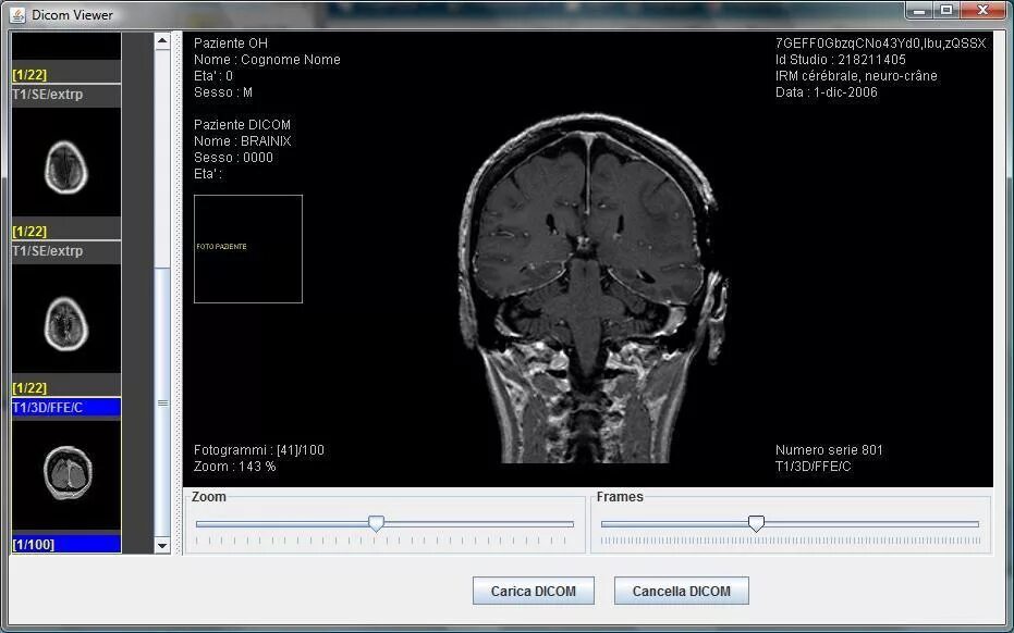 Dicom viewer. Dicom web viewer. dicom в медицине. dicom portable viewer. dicom просмотрщик аппарат.