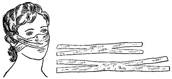 Пращевидная перевязка. Пращевидная повязка на нос алгоритм. Техника наложения пращевидной повязки. Наложение повязки на нос пращевидная повязка. Пращевидная на нос повязка характеристика.
